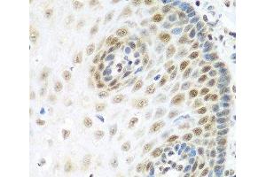 Immunohistochemistry of paraffin-embedded Human esophagus using MDC1 Polyclonal Antibody at dilution of 1:100 (40x lens). (MDC1 抗体)