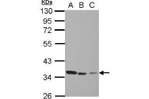 WB Image Sample (30 ug of whole cell lysate) A: Jurkat B: Raji C: THP-1 10% SDS PAGE antibody diluted at 1:1000 (TYMS 抗体)
