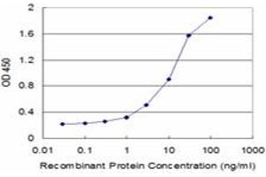 Detection limit for recombinant GST tagged IL11 is approximately 0. (IL-11 抗体  (AA 25-74))