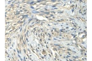 Immunohistochemistry (IHC) image for anti-Calmodulin Like Protein 3 (CALML3) (AA 1-149) antibody (ABIN7436177)