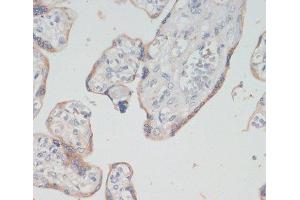 Immunohistochemistry of paraffin-embedded Human placenta using CHAT Polyclonal Antibody at dilution of 1:200 (40x lens). (Choline Acetyltransferase 抗体)