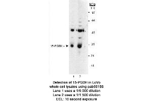 Image no. 1 for anti-Hydroxyprostaglandin Dehydrogenase 15-(NAD) (HPGD) antibody (ABIN363465) (HPGD 抗体)
