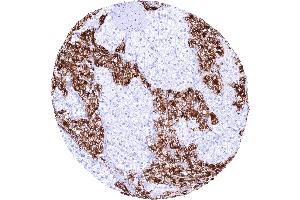 Adrenal gland with a strong cytoplasmic and membranous TH staining of medullary cells while adrenocortical cells remain negative