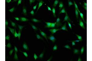 Immunofluorescence staining of NIH/3T3 cells with ABIN7160120 at 1:400, counter-stained with DAPI.
