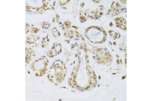 Immunohistochemistry of paraffin-embedded human breast using ILF2 Antibody (ABIN5973487) at dilution of 1/100 (40x lens).