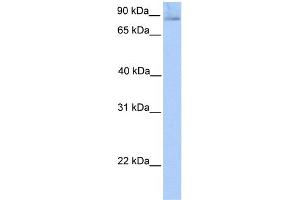 WB Suggested Anti-SLITRK1 Antibody Titration:  0. (SLITRK1 抗体  (N-Term))