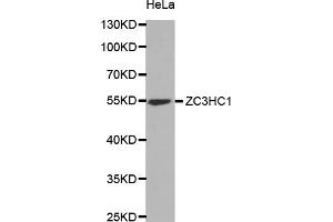 Western blot analysis of extracts of HeLa cells, using ZC3HC1 antibody (ABIN5973745) at 1/1000 dilution. (ZC3HC1 抗体)