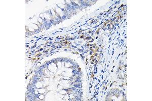 Immunohistochemistry (IHC) image for anti-Leukocyte Immunoglobulin-Like Receptor, Subfamily B (With TM and ITIM Domains), Member 4 (LILRB4) (AA 22-259) antibody (ABIN6143221)