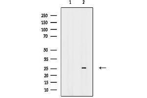 Western blot analysis of lysates from PC12(H2O2 treatment), using ZNF230 Antibody.