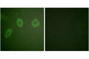 Immunofluorescence analysis of HuvEc cells, using HER2 (Ab-686) Antibody. (ErbB2/Her2 抗体  (AA 661-710))