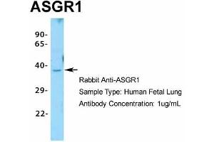 Host:  Rabbit  Target Name:  ASGR1  Sample Type:  Human Fetal Lung  Antibody Dilution:  1. (Asialoglycoprotein Receptor 1 抗体  (N-Term))