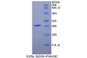 SDS-PAGE (SDS) image for CD79b Molecule, Immunoglobulin-Associated beta (CD79B) (AA 26-225) protein (His tag) (ABIN2125235)