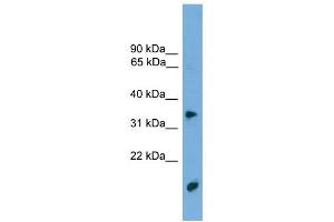 TMPRSS3 antibody used at 1 ug/ml to detect target protein. (TMPRSS3 抗体  (N-Term))