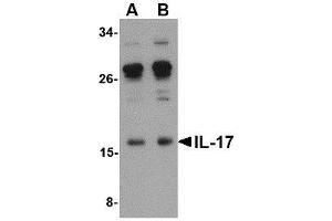 Western blot analysis of IL-17 in A-20 lysate with AP30410PU-N IL-17 antibody at (A) 0. (Interleukin 17a 抗体  (Center))