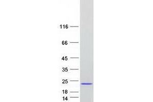 Western Blotting (WB) image for Eukaryotic Translation Initiation Factor 5A (EIF5A) (Transcript Variant C) protein (Myc-DYKDDDDK Tag) (ABIN2720108)