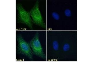 Immunofluorescence (IF) image for anti-Synaptic Vesicle Glycoprotein 2A (SV2A) (Internal Region) antibody (ABIN185715)