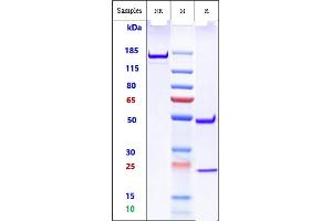 Anti-TREM2 Reference Antibody (Py314) on SDS-PAGE under reducing (R) condition. (Recombinant TREM2 抗体)