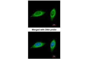 Immunofluorescence (IF) image for anti-Methylenetetrahydrofolate Dehydrogenase (NADP+ Dependent) 2, Methenyltetrahydrofolate Cyclohydrolase (MTHFD2) antibody (ABIN2856008)