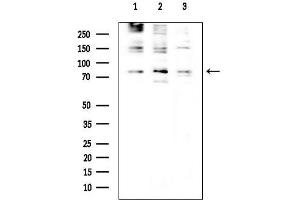 anti-Eukaryotic Elongation Factor-2 Kinase (EEF2K) (Internal Region) antibody
