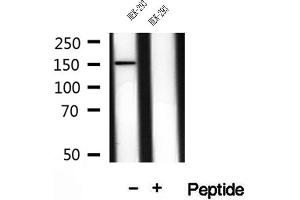 Western blot analysis of extracts of HEK-293 cells, using VPRBP antibody. (VPRBP 抗体)
