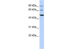 KCND3 antibody used at 1 ug/ml to detect target protein. (KCND3 抗体  (Middle Region))
