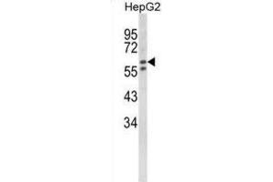 Western Blotting (WB) image for anti-Hexosaminidase A (HEXA) antibody (ABIN3002900) (Hexosaminidase A 抗体)