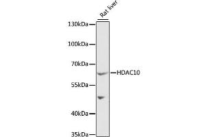 Western blot analysis of extracts of rat liver, using HDAC10 antibody (ABIN1882316) at 1:1000 dilution. (HDAC10 抗体)