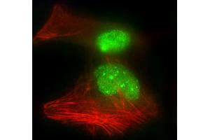 Immunofluorescent analysis of 4 % paraformaldehyde-fixed, 0. (HNRNPR 抗体  (N-Term))