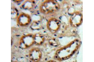 Used in DAB staining on fromalin fixed paraffin-embedded Kidney tissue (ACE2 抗体  (AA 93-464))