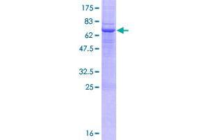 Image no. 1 for MHC Class I Polypeptide-Related Sequence B (MICB) (AA 1-340) protein (GST tag) (ABIN1310917)