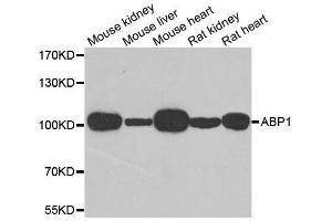 Western blot analysis of extracts of various cell lines, using AOC1 antibody. (DAO 抗体  (AA 20-300))
