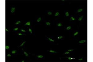 Immunofluorescence of monoclonal antibody to FOXC2 on HeLa cell. (FOXC2 抗体  (AA 156-256))