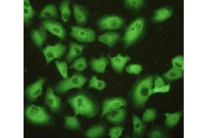 Detection of UCHL1 in A549 cells using Polyclonal Antibody to Ubiquitin Carboxyl Terminal Hydrolase L1 (UCHL1) (UCHL1 抗体  (AA 2-223))