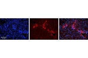 Rabbit Anti-ETF1 Antibody Catalog Number: ARP54738_P050 Formalin Fixed Paraffin Embedded Tissue: Human Liver Tissue Observed Staining: Cytoplasm in bile ductule Primary Antibody Concentration: 1:100 Other Working Concentrations: 1:600 Secondary Antibody: Donkey anti-Rabbit-Cy3 Secondary Antibody Concentration: 1:200 Magnification: 20X Exposure Time: 0. (ETF1 抗体  (N-Term))