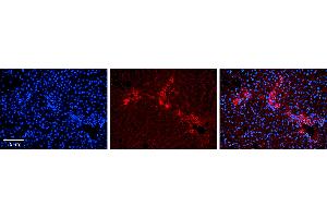 Rabbit Anti-ETF1 Antibody Catalog Number: ARP54738_P050 Formalin Fixed Paraffin Embedded Tissue: Human Liver Tissue Observed Staining: Cytoplasm in bile ductule Primary Antibody Concentration: 1:100 Other Working Concentrations: 1:600 Secondary Antibody: Donkey anti-Rabbit-Cy3 Secondary Antibody Concentration: 1:200 Magnification: 20X Exposure Time: 0.