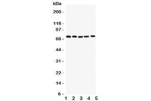 Western blot testing of Kv1. (Kv1.4 抗体  (Middle Region))