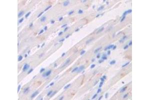 IHC-P analysis of Mouse Tissue, with DAB staining. (CACNA1C 抗体  (AA 1978-2139))