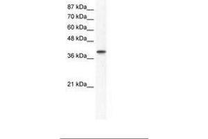 Image no. 1 for anti-Transcription Factor AP-4 (Activating Enhancer Binding Protein 4) (TFAP4) (AA 198-247) antibody (ABIN202279) (TFAP4 抗体  (AA 198-247))