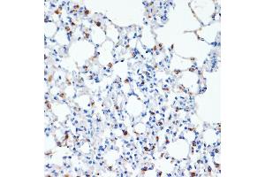 Immunohistochemistry (IHC) image for anti-Surfactant Protein C (SFTPC) (AA 1-197) antibody (ABIN3015598)
