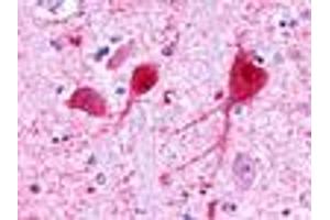 Anti-GALR3 antibody IHC of human brain, neurons and glia. (GALR3 抗体  (C-Term))