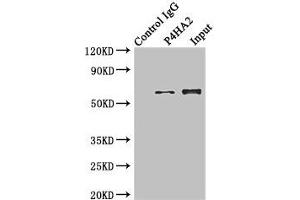 Immunoprecipitating P4HA2 in Hela whole cell lysate Lane 1: Rabbit control IgG instead of (1 μg) instead of ABIN7164785 in Hela whole cell lysate. (P4HA2 抗体  (AA 236-535))