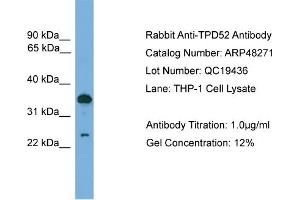 WB Suggested Anti-TPD52  Antibody Titration: 0. (TPD52 抗体  (C-Term))