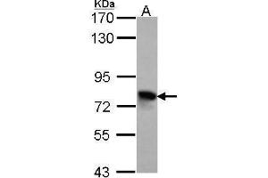 WB Image Sample (30 ug of whole cell lysate) A: Hela 7. (TGFBI 抗体)