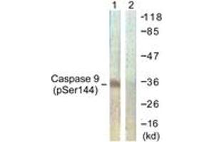 Western blot analysis of extracts from K562 cells, using Caspase 9 (Phospho-Ser144) Antibody. (Caspase 9 抗体  (pSer144))