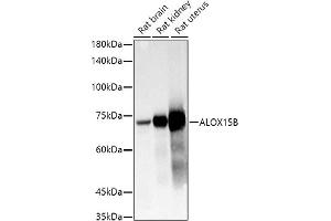 Western blot analysis of extracts of various cell lines, using B antibody (ABIN6129899, ABIN6136816, ABIN6136817 and ABIN6222589) at 1:1000 dilution. (ALOX15B 抗体  (AA 1-200))