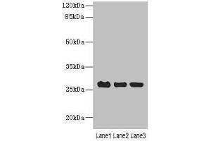 Western blot All lanes: C10orf82 antibody at 1 μg/mL Lane 1: A431 whole cell lysate Lane 2: HepG2 whole cell lysate Lane 3: Mouse thymus tissue Secondary Goat polyclonal to rabbit IgG at 1/10000 dilution Predicted band size: 27, 18, 13 kDa Observed band size: 27 kDa
