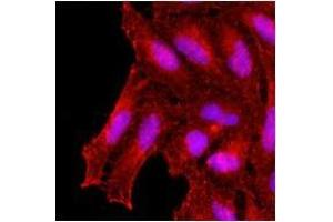 Immunofluorescenitrocellulosee of human HeLa cells stained with monoclonal anti-human KCDT15 antibody (1:500) with Texas Red (Red). (KCTD15 抗体)