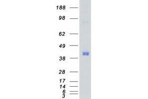 Western Blotting (WB) image for Calcium/calmodulin-Dependent Protein Kinase I (CAMK1) protein (Myc-DYKDDDDK Tag) (ABIN2713084)