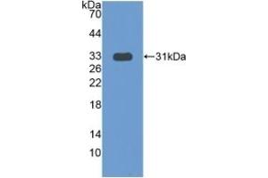 Detection of Recombinant COIL, Human using Polyclonal Antibody to Coilin (COIL) (Coilin 抗体  (AA 319-538))