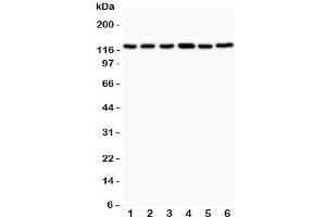 Western blot testing of Bub1 antibody and Lane 1:  rat testis;  2: (r) ovary;  3: (r) liver;  4: human Jurkat;  5: (h) COLO320;  6: (h) HEPG2. (BUB1 抗体  (AA 731-1085))